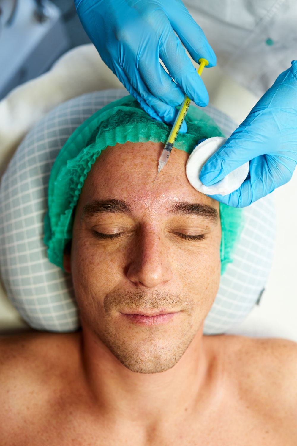 Traitement des rides du front chez un homme avec neuromodulateur, à L'Épiphanie.